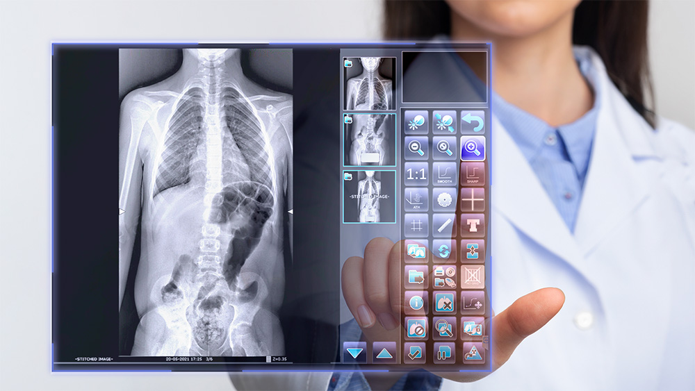Guía para la renovación y actualización tecnológica en Radiología